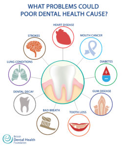 Oral health neglect leads to an overall to serious health issues